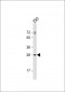 UNC50 Antibody (N-term)
